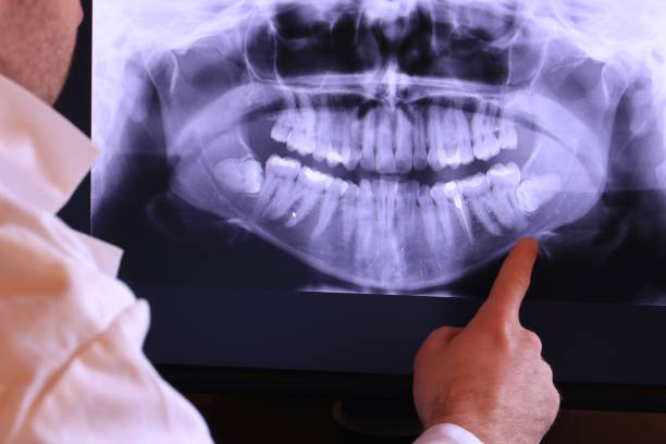 Best Emergency Treatment for Toothache in Salem Lakes, WI